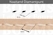 Diamond Stitching Chisel 2 prong (4 mm apart), 88046-02 - pict. 2